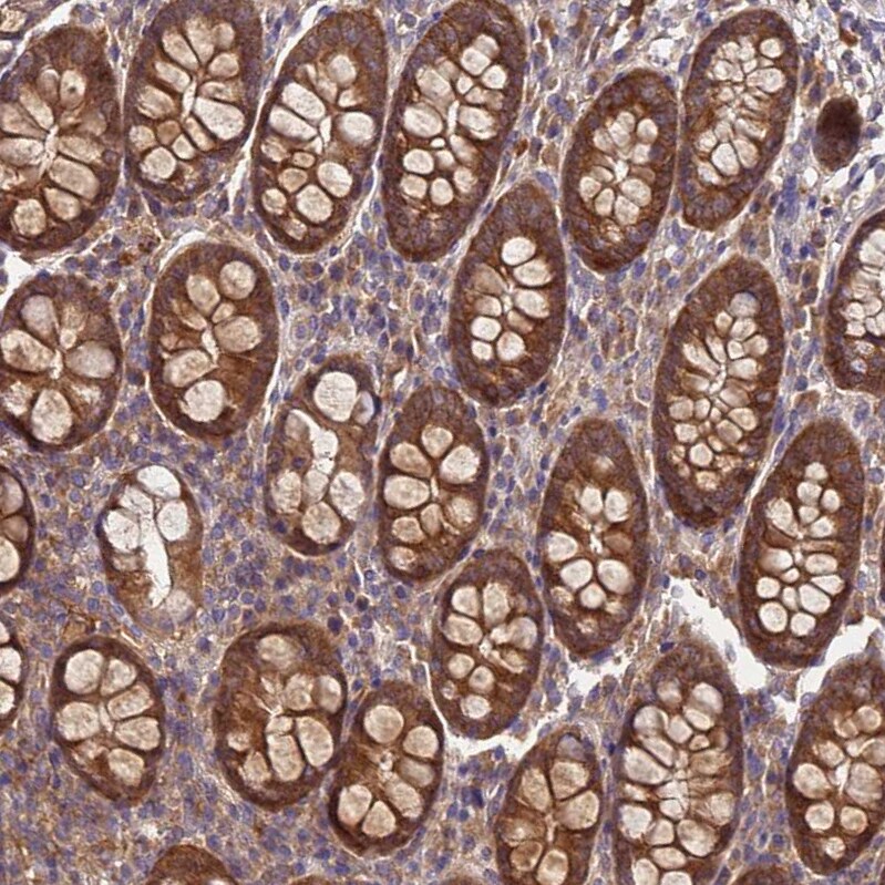 GSPT2 Antibody - BSA Free Immunohistochemistry: GSPT2 Antibody - BSA Free [NBP1-91971]