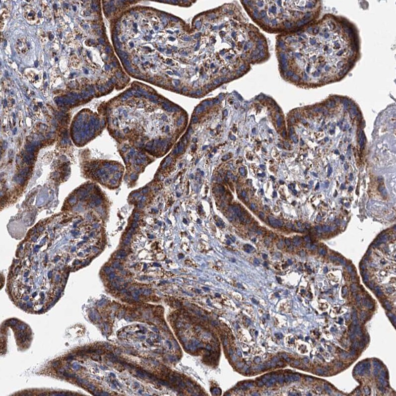GTPBP3 Antibody - BSA Free Immunohistochemistry: GTPBP3 Antibody - BSA Free [NBP1-91974]
