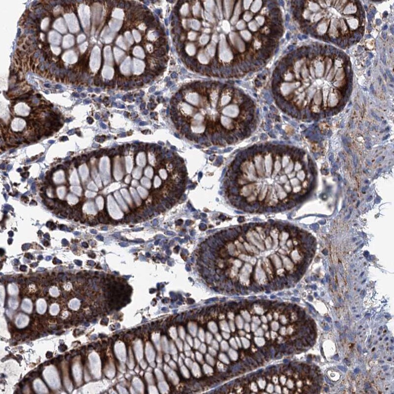 GTPBP3 Antibody - BSA Free Immunohistochemistry: GTPBP3 Antibody - BSA Free [NBP1-91974]