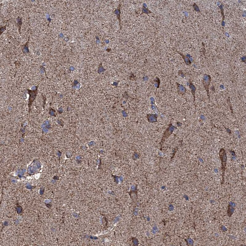 GTPBP3 Antibody - BSA Free Immunohistochemistry: GTPBP3 Antibody - BSA Free [NBP1-91974]