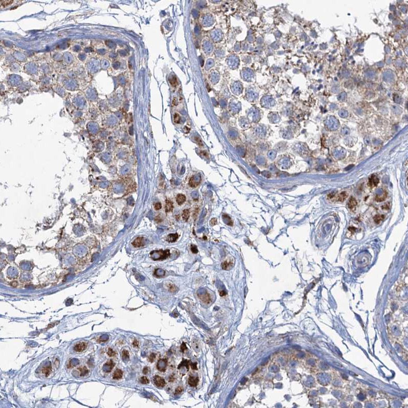 GTPBP3 Antibody - BSA Free Immunohistochemistry: GTPBP3 Antibody - BSA Free [NBP1-91974]