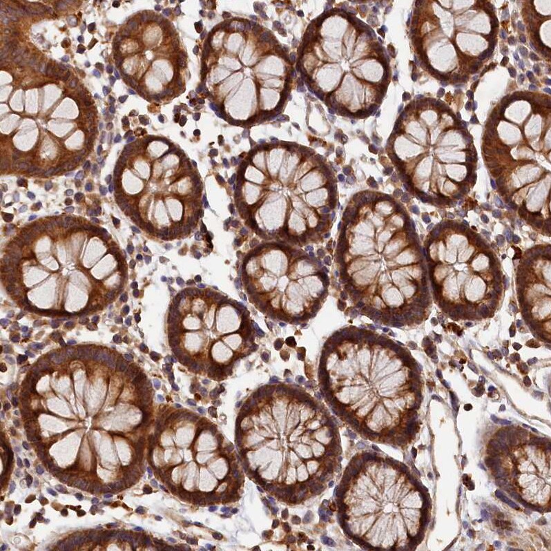 HO-2/HMOX2 Antibody - BSA Free Immunohistochemistry: HO-2/HMOX2 Antibody - BSA Free [NBP1-91981]