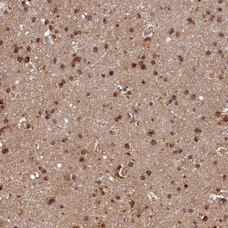 HO-2/HMOX2 Antibody - BSA Free Immunohistochemistry: HO-2/HMOX2 Antibody - BSA Free [NBP1-91981]