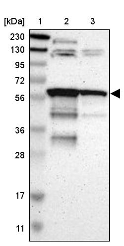 HIV-1 Rev binding protein Antibody - BSA Free Western Blot: HIV-1 Rev binding protein Antibody - BSA Free [NBP1-91991]
