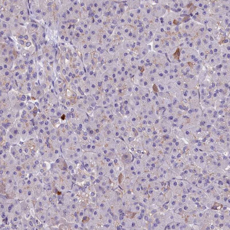 HLA DOA Antibody - BSA Free Immunohistochemistry: HLA DOA Antibody - BSA Free [NBP1-91993]