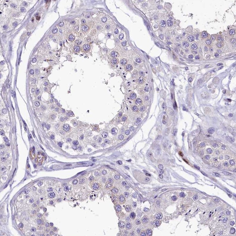 HLA DOA Antibody - BSA Free Immunohistochemistry: HLA DOA Antibody - BSA Free [NBP1-91993]
