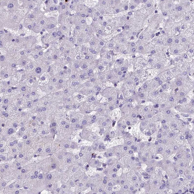 HLA DOA Antibody - BSA Free Immunohistochemistry: HLA DOA Antibody - BSA Free [NBP1-91993]