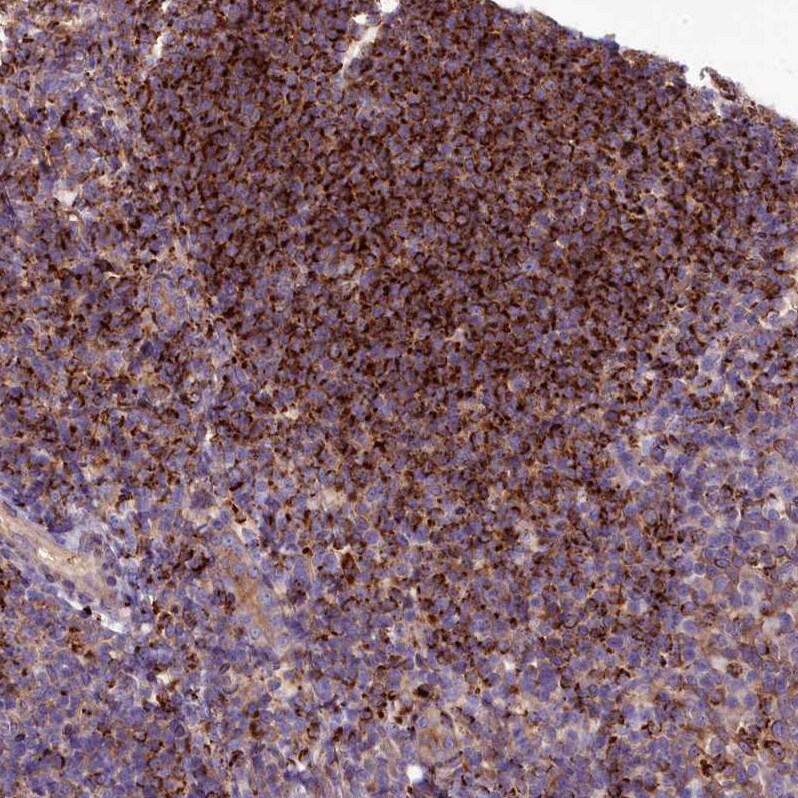 HLA DOA Antibody - BSA Free Immunohistochemistry: HLA DOA Antibody - BSA Free [NBP1-91993]