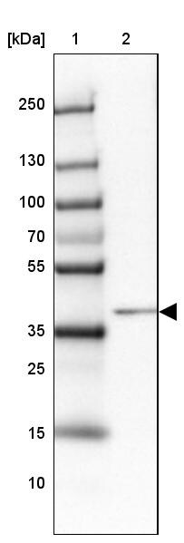 HNF-6/ONECUT1 Antibody - BSA Free Western Blot: HNF-6/ONECUT1 Antibody - BSA Free [NBP1-91998]