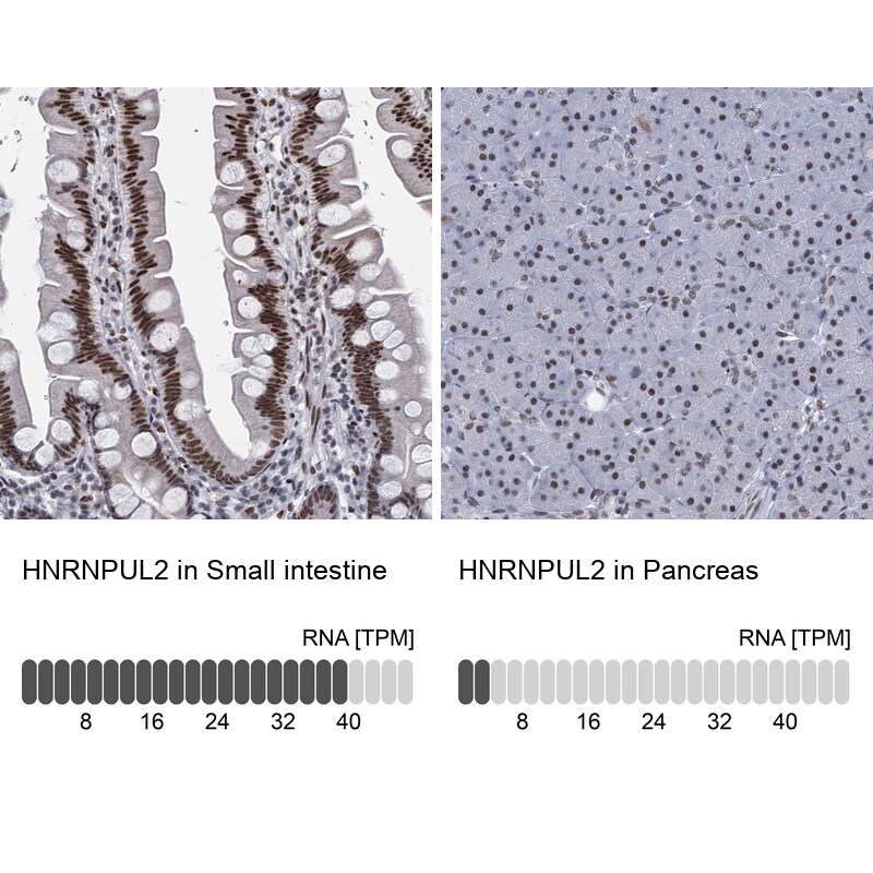 HNRNPUL2 Antibody - BSA Free Immunohistochemistry: HNRNPUL2 Antibody - BSA Free [NBP1-92001]