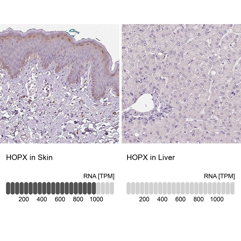 HOP Antibody - BSA Free Immunohistochemistry: HOP Antibody - BSA Free [NBP1-92003]