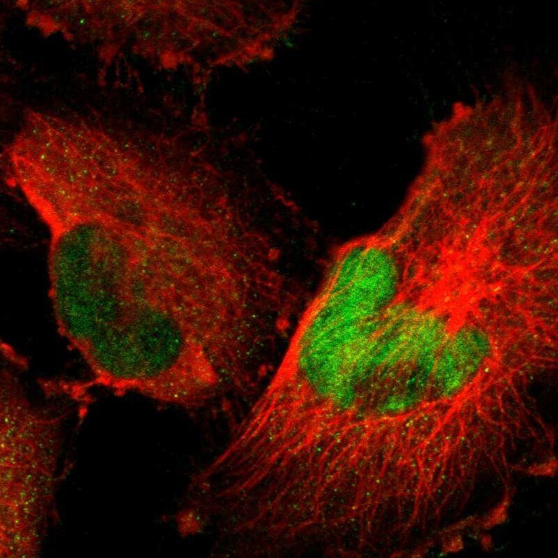 Host cell factor C2 Antibody - BSA Free Immunocytochemistry/ Immunofluorescence: Host cell factor C2 Antibody [NBP1-92004]