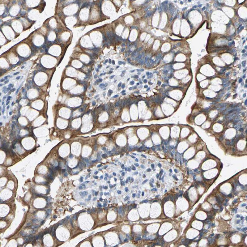 Host cell factor C2 Antibody - BSA Free Immunohistochemistry: Host cell factor C2 Antibody - BSA Free [NBP1-92004]