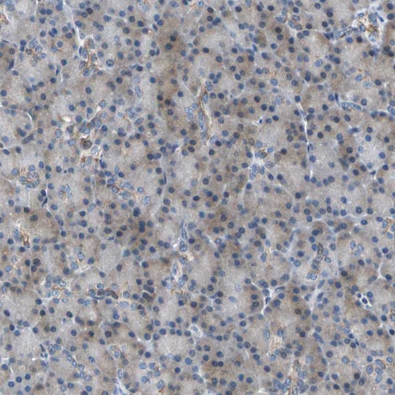 Host cell factor C2 Antibody - BSA Free Immunohistochemistry: Host cell factor C2 Antibody - BSA Free [NBP1-92004]