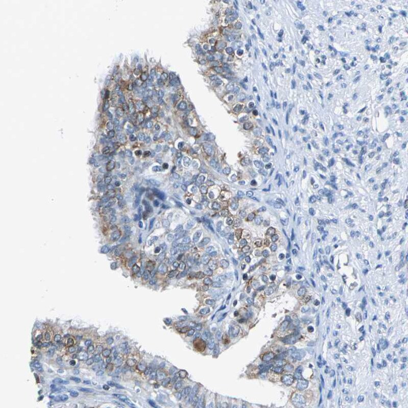 Host cell factor C2 Antibody - BSA Free Immunohistochemistry: Host cell factor C2 Antibody - BSA Free [NBP1-92004]
