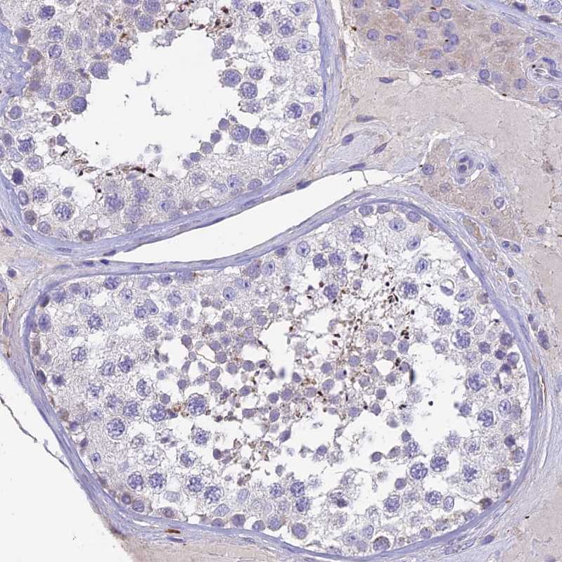 HSD17B2 Antibody - BSA Free Immunohistochemistry: HSD17B2 Antibody - BSA Free [NBP1-92011]