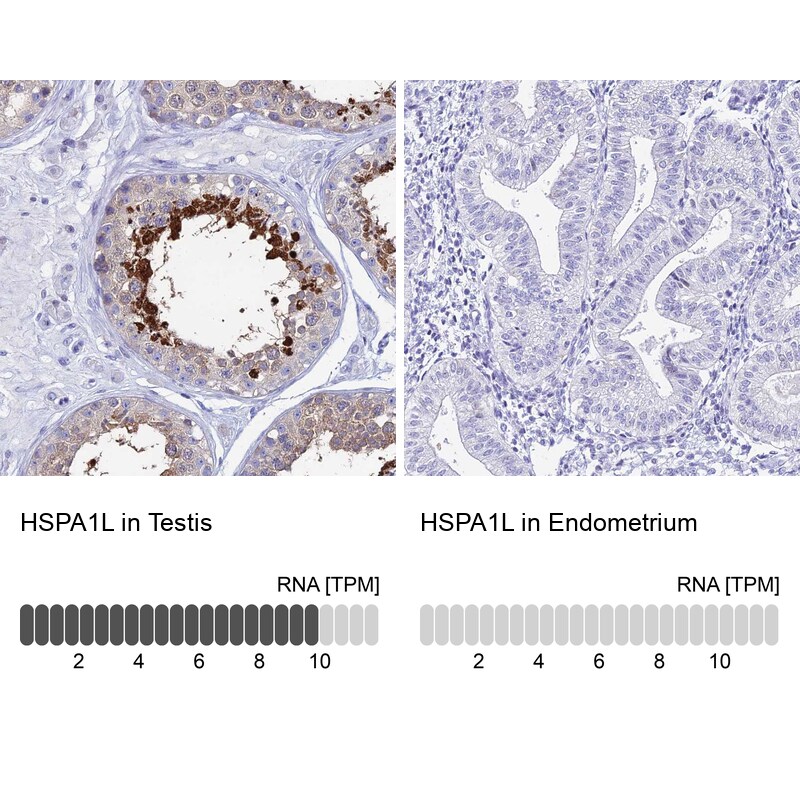HspA1L Antibody - BSA Free Immunohistochemistry: HspA1L Antibody - BSA Free [NBP1-92012]