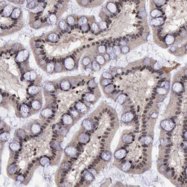 HTF9C Antibody - BSA Free Immunohistochemistry: HTF9C Antibody - BSA Free [NBP1-92016]
