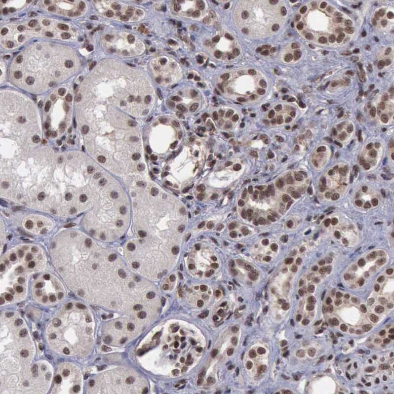 HTF9C Antibody - BSA Free Immunohistochemistry: HTF9C Antibody - BSA Free [NBP1-92016]