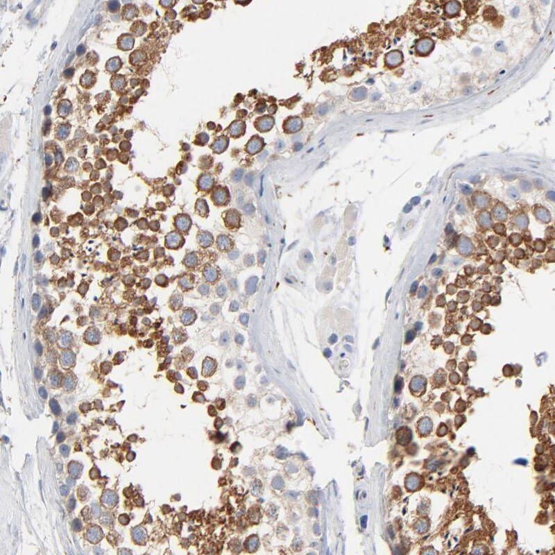 IFT43 Antibody - BSA Free Immunohistochemistry: IFT43 Antibody - BSA Free [NBP1-92019]