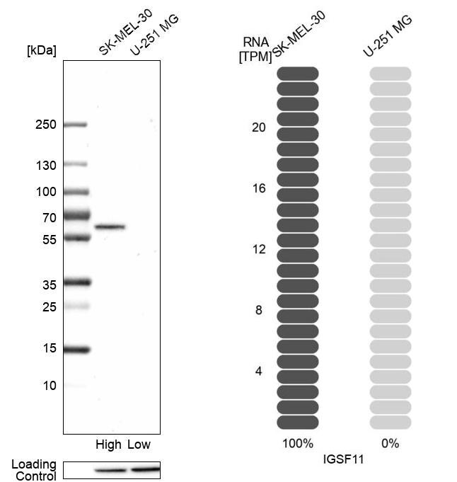 VSIG3/IGSF11 Antibody - BSA Free Western Blot: VSIG3/IGSF11 Antibody - BSA Free [NBP1-92021]