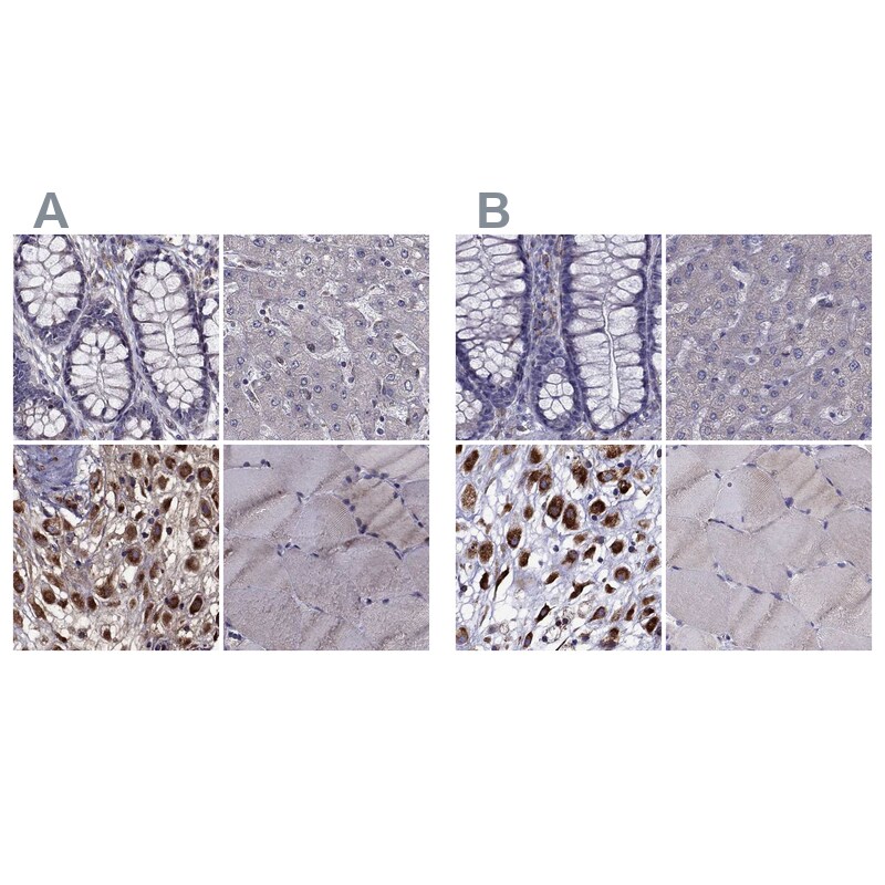 IKIP Antibody - BSA Free Immunohistochemistry-Paraffin: IKIP Antibody [NBP1-92022]