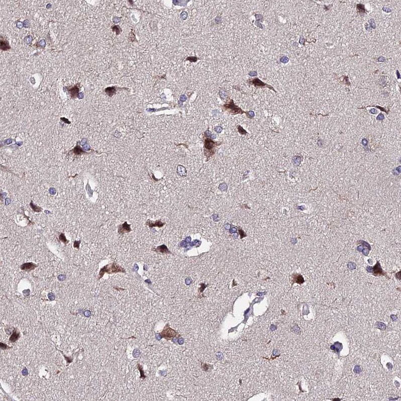 INPP4A Antibody - BSA Free Immunohistochemistry: INPP4A Antibody - BSA Free [NBP1-92023]