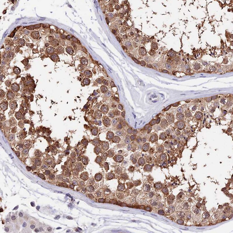 INPP4A Antibody - BSA Free Immunohistochemistry: INPP4A Antibody - BSA Free [NBP1-92023]