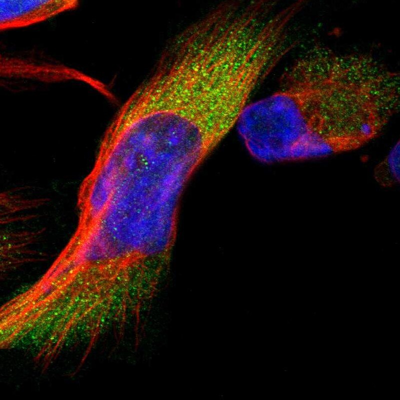 Invadolysin Antibody - BSA Free Immunocytochemistry/ Immunofluorescence: Invadolysin Antibody [NBP1-92024]