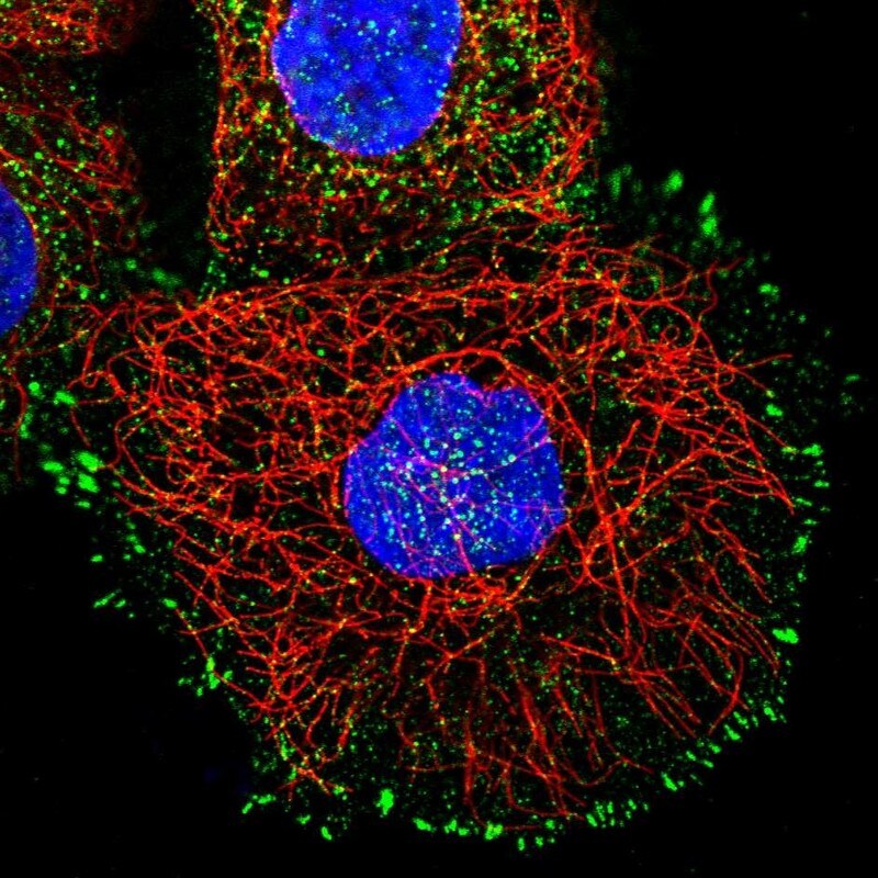 Invadolysin Antibody - BSA Free Immunocytochemistry/ Immunofluorescence: Invadolysin Antibody [NBP1-92025]