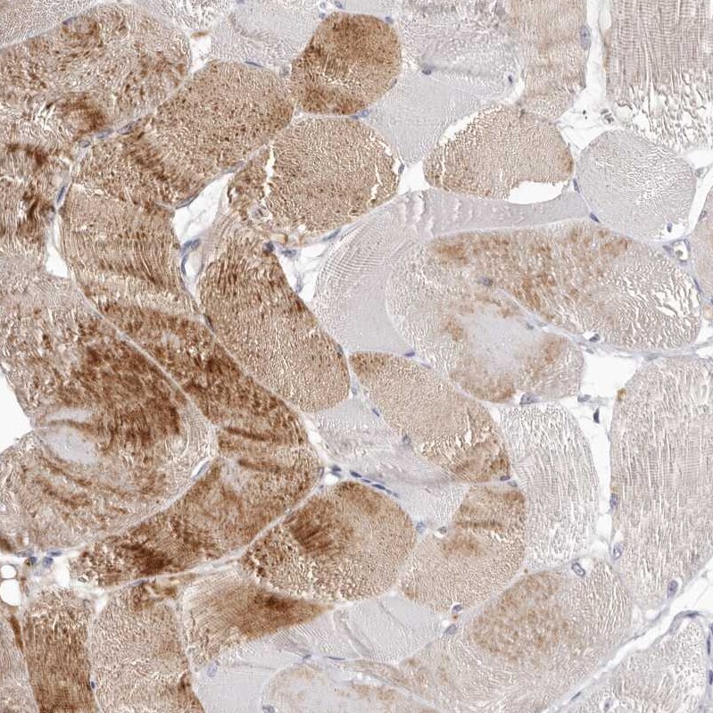 Invadolysin Antibody - BSA Free Immunohistochemistry: Invadolysin Antibody - BSA Free [NBP1-92025]