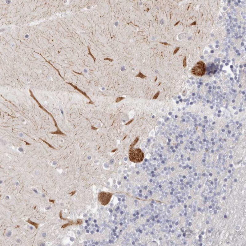 Invadolysin Antibody - BSA Free Immunohistochemistry: Invadolysin Antibody - BSA Free [NBP1-92025]