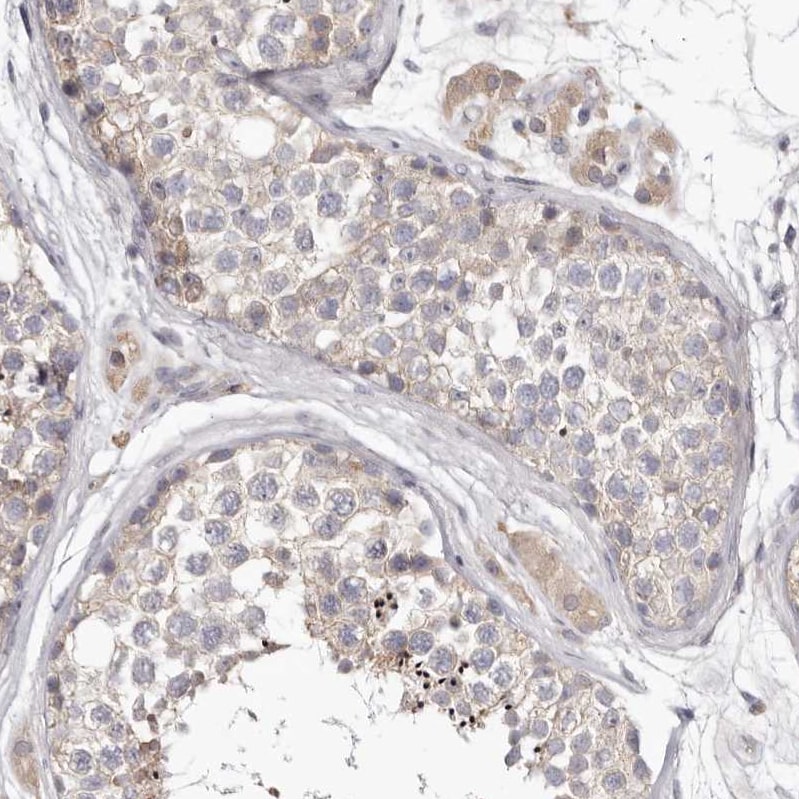 Invadolysin Antibody - BSA Free Immunohistochemistry: Invadolysin Antibody - BSA Free [NBP1-92025]