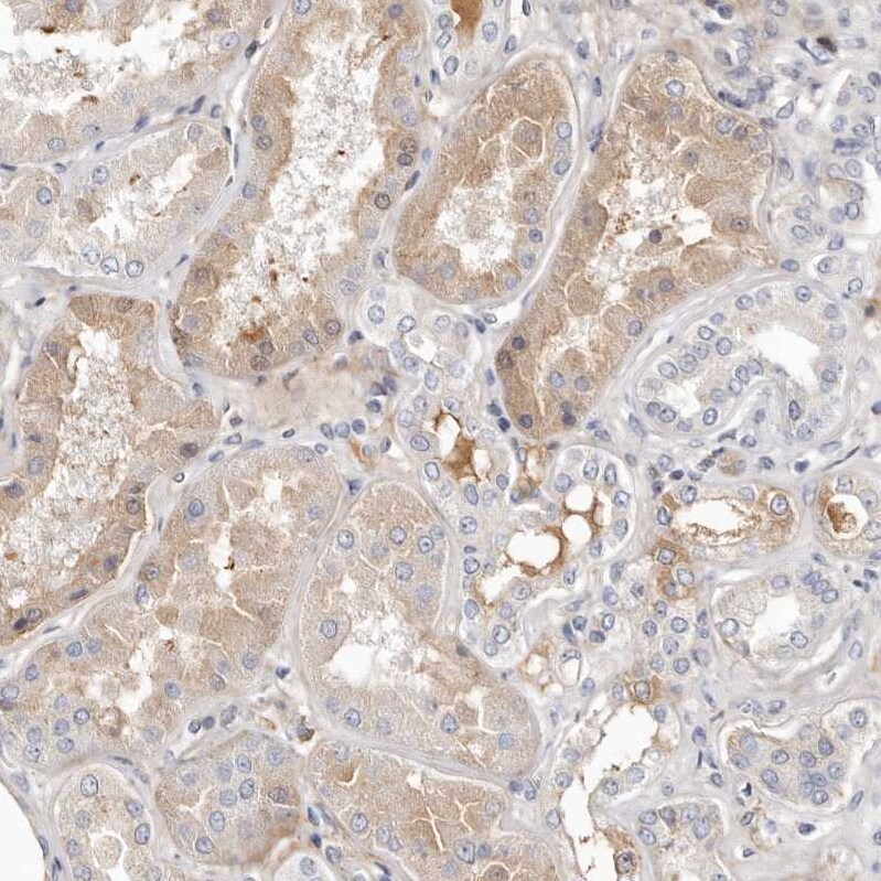 Invadolysin Antibody - BSA Free Immunohistochemistry: Invadolysin Antibody - BSA Free [NBP1-92025]