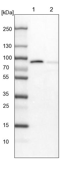 Invadolysin Antibody - BSA Free Western Blot: Invadolysin Antibody - BSA Free [NBP1-92025]