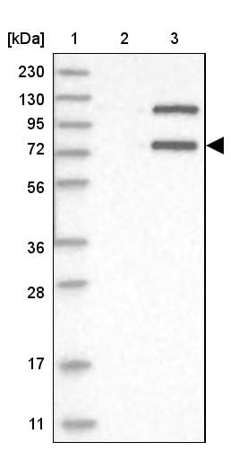 Invadolysin Antibody - BSA Free Western Blot: Invadolysin Antibody - BSA Free [NBP1-92025]