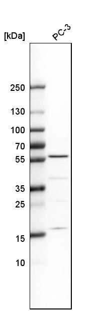 IP6K1 Antibody - BSA Free Western Blot: IP6K1 Antibody - BSA Free [NBP1-92026]