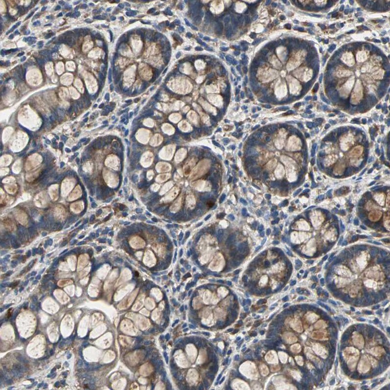IRF3 Antibody - BSA Free Immunohistochemistry: IRF3 Antibody - BSA Free [NBP1-92028]
