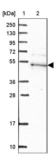 Kaptin Antibody - BSA Free Western Blot: Kaptin Antibody - BSA Free [NBP1-92035]