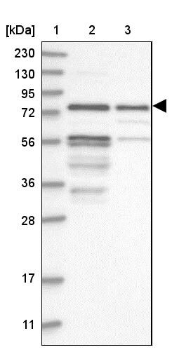 Kazrin Antibody - BSA Free Western Blot: Kazrin Antibody - BSA Free [NBP1-92038]
