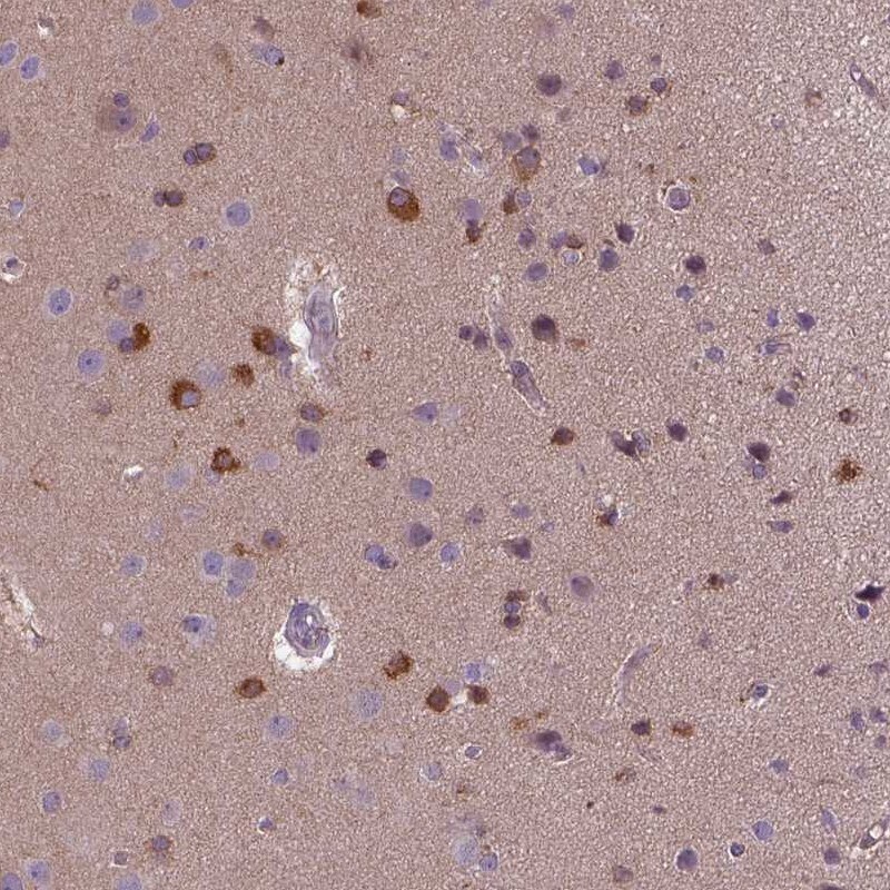 Kazrin Antibody - BSA Free Immunohistochemistry: Kazrin Antibody - BSA Free [NBP1-92038]