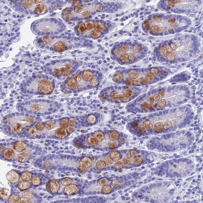 KDELR3 Antibody - BSA Free Immunohistochemistry: KDELR3 Antibody - BSA Free [NBP1-92048]
