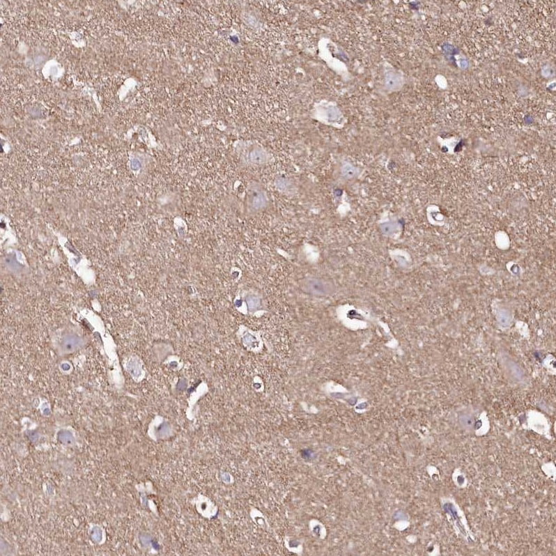 KIBRA Antibody - BSA Free Immunohistochemistry: KIBRA Antibody - BSA Free [NBP1-92053]