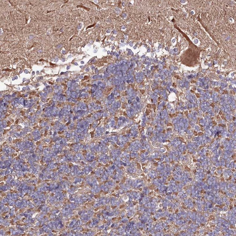 KIBRA Antibody - BSA Free Immunohistochemistry: KIBRA Antibody - BSA Free [NBP1-92053]
