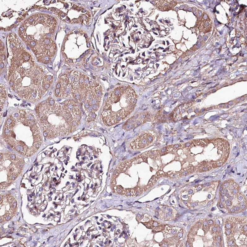 KIBRA Antibody - BSA Free Immunohistochemistry: KIBRA Antibody - BSA Free [NBP1-92053]