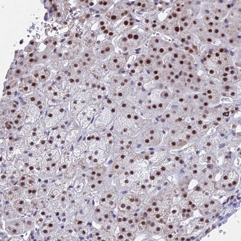 KLF14 Antibody - BSA Free Immunohistochemistry: KLF14 Antibody - BSA Free [NBP1-92058]