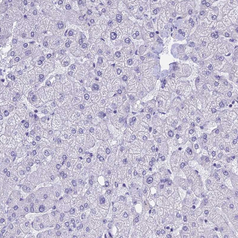 KLF14 Antibody - BSA Free Immunohistochemistry: KLF14 Antibody - BSA Free [NBP1-92058]