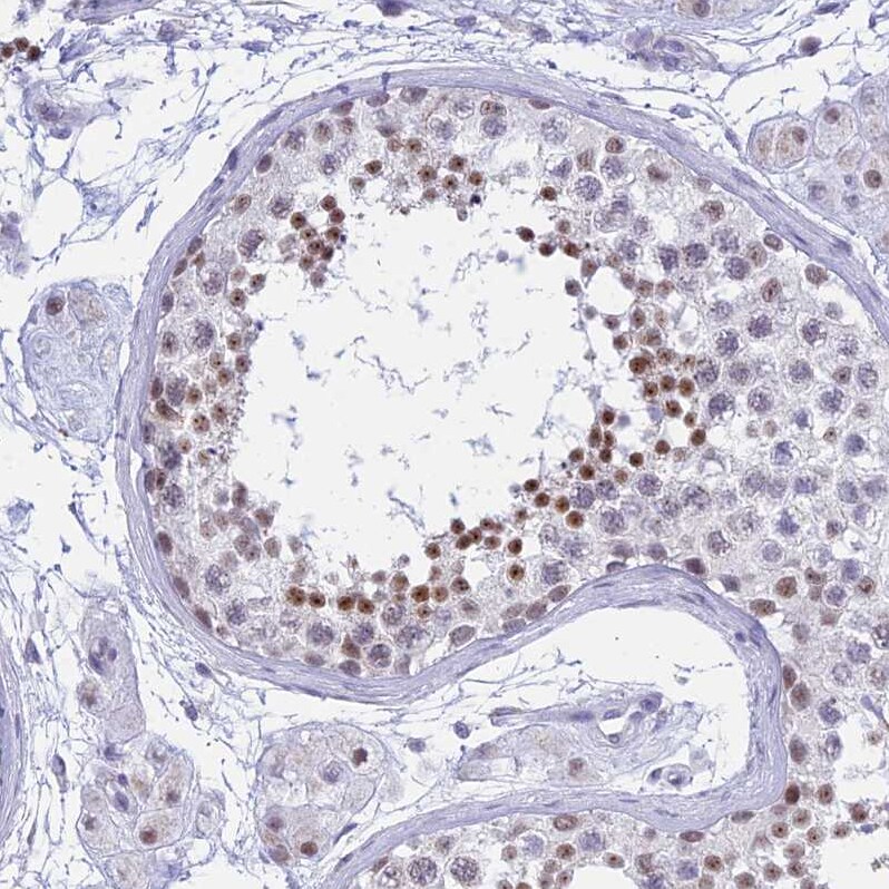 KLF14 Antibody - BSA Free Immunohistochemistry: KLF14 Antibody - BSA Free [NBP1-92058]