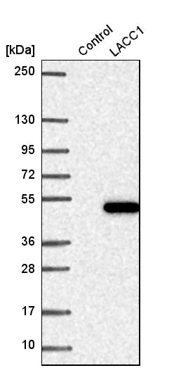 LACC1 Antibody - BSA Free Western Blot: LACC1 Antibody - BSA Free [NBP1-92062]