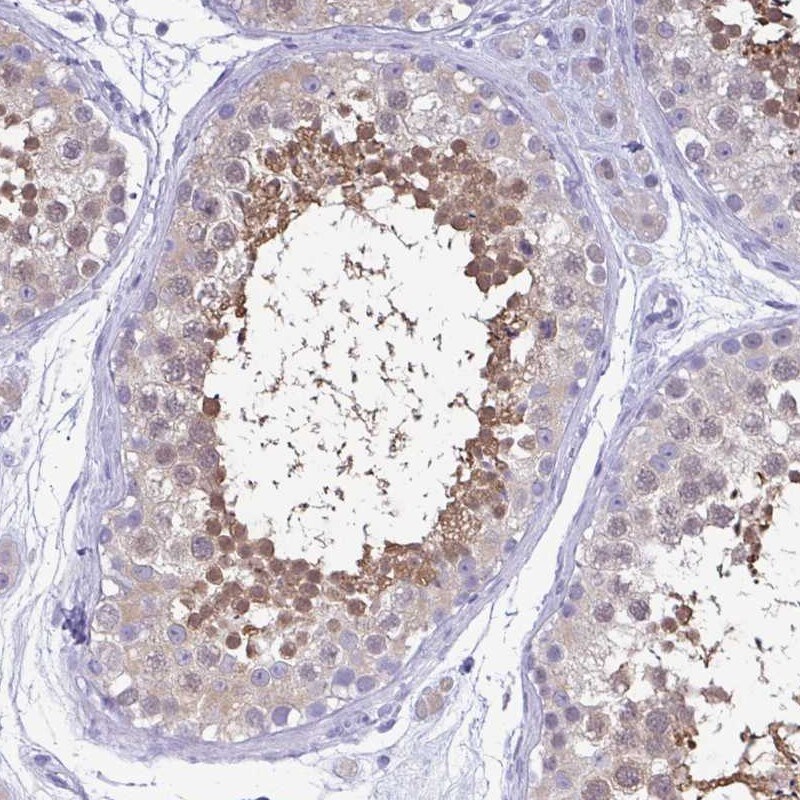 Lactate Dehydrogenase C Antibody - BSA Free Immunohistochemistry: Lactate Dehydrogenase C Antibody - BSA Free [NBP1-92065]